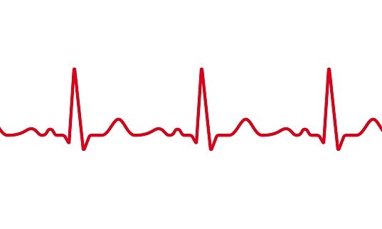 Heart monitor line